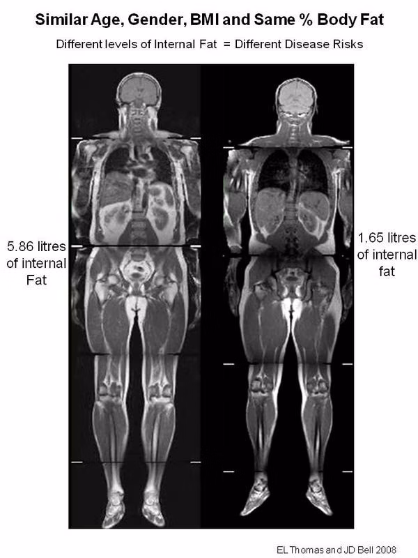 What Counts as Fat?